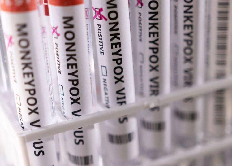 2022 05 23t222423z 1 lynxnpei4m100 rtroptp 4 health monkeypox 1